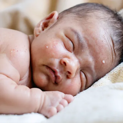 Акне новорожденных форум: подробная инструкция и важные нюансы